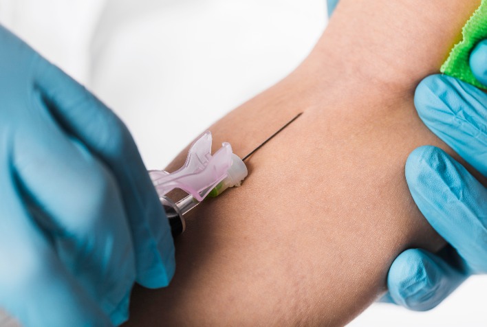 Prefeitura de Viçosa disponibiliza exames de PSA para homens